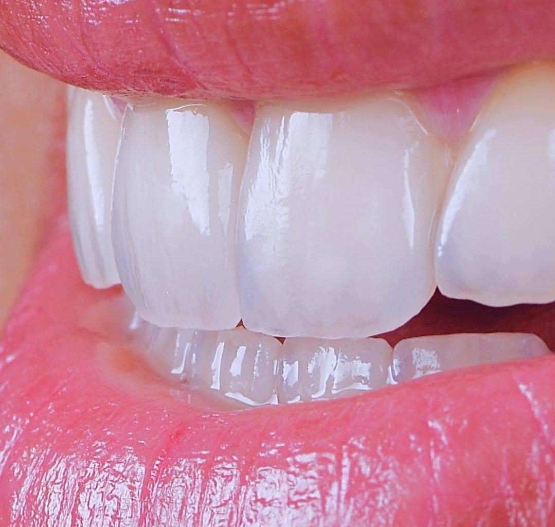 Estetică dentară — zâmbet natural Dent SmartElit